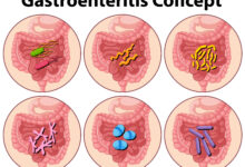 wellhealthorganic.com : key signs of gastroenteritis